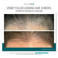 FactorFive Shampoo Advanced Haircare