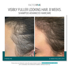 FactorFive Shampoo Advanced Haircare