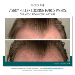 FactorFive Shampoo Advanced Haircare