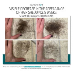 FactorFive Shampoo Advanced Haircare